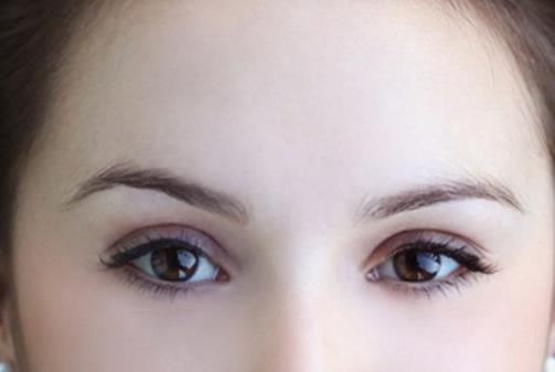 腫眼泡吸脂安全嗎?價格多少?