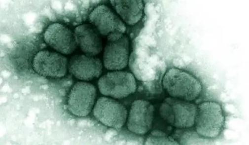 國內(nèi)感染猴痘病毒的可能性大嗎 人感染猴痘病毒能自愈嗎