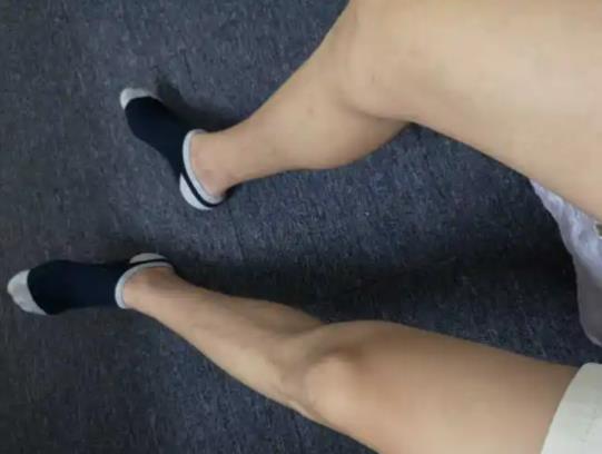 腿毛摩擦掉了還會長嗎?男人沒腿毛正常嗎