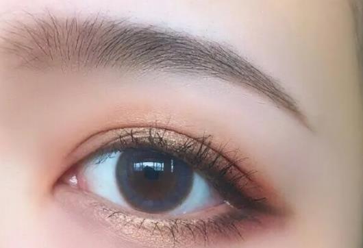 雙眼皮緊繃感多久消失?割雙眼皮多久能恢復正常 雙眼皮緊繃感多久消失?割雙眼皮多久能恢復正常