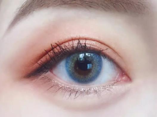 雙眼皮太寬太深去哪里修復好?雙眼皮疤痕凹陷能自然長平嗎 雙眼皮太寬太深去哪里修復好?雙眼皮疤痕凹陷能自然長平嗎