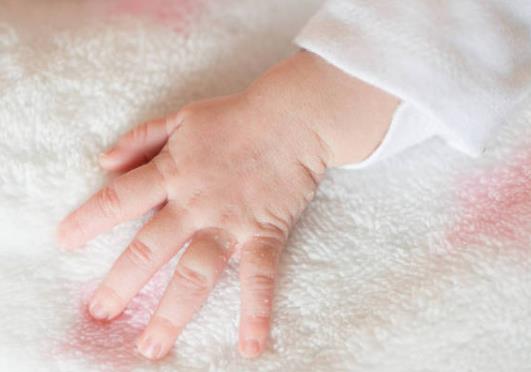 混合喂養(yǎng)如何斷奶?斷奶奶漲怎么辦 混合喂養(yǎng)如何斷奶?斷奶奶漲怎么辦