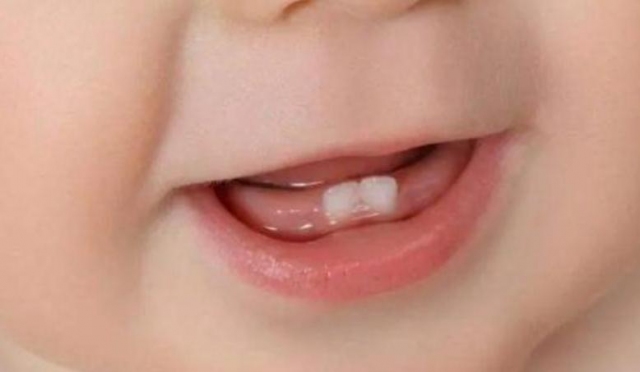 嬰兒第一次長牙要哭鬧幾天?嬰兒長牙為什么會哭鬧 嬰兒第一次長牙要哭鬧幾天?嬰兒長牙為什么會哭鬧