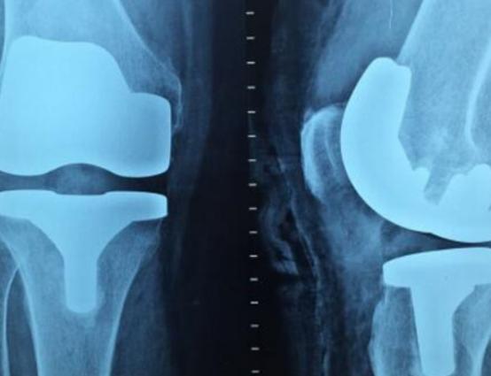 世界十大偶然發(fā)明排名,炸藥、冰淇淋錐的發(fā)明都是個意外 世界十大偶然發(fā)明排名,炸藥、冰淇淋錐的發(fā)明都是個意外