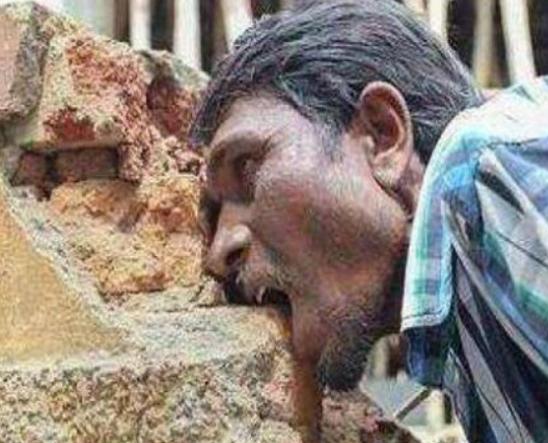 世界十大治不愈的病,慢性疲勞綜合癥、自身免疫失調(diào)都是慢性難治療 世界十大治不愈的病,慢性疲勞綜合癥、自身免疫失調(diào)都是慢性難治療