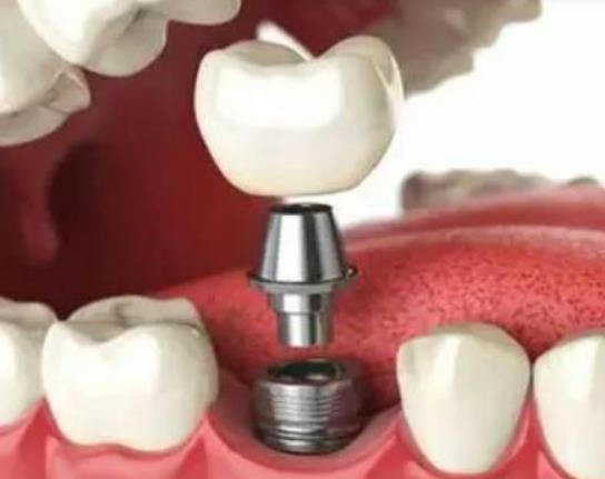 NֲһwXXNֲxXޏ(f)Ҫ