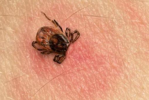 隱翅蟲是怎么來的?隱翅蟲咬的包是啥樣子 隱翅蟲是怎么來的?隱翅蟲咬的包是啥樣子