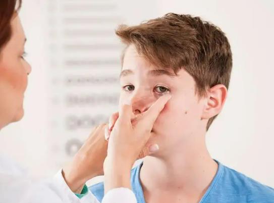 ok鏡刮花了能修復(fù)嗎?成人戴ok鏡有用嗎